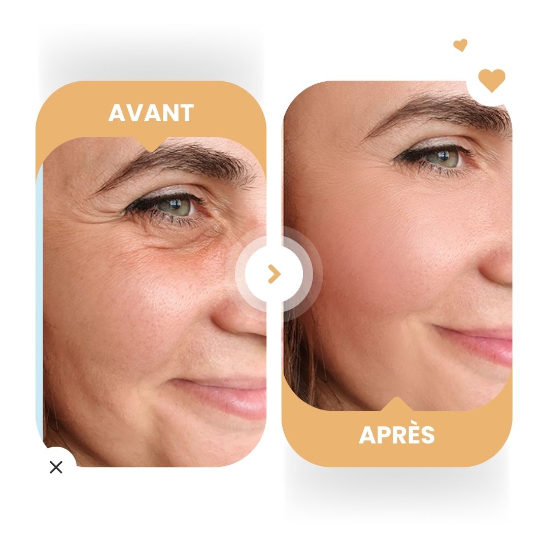 Comparaison avant-après. Visage d'une femme. Gauche : rides. Droite : peau plus lisse. Flèche. Coeurs.