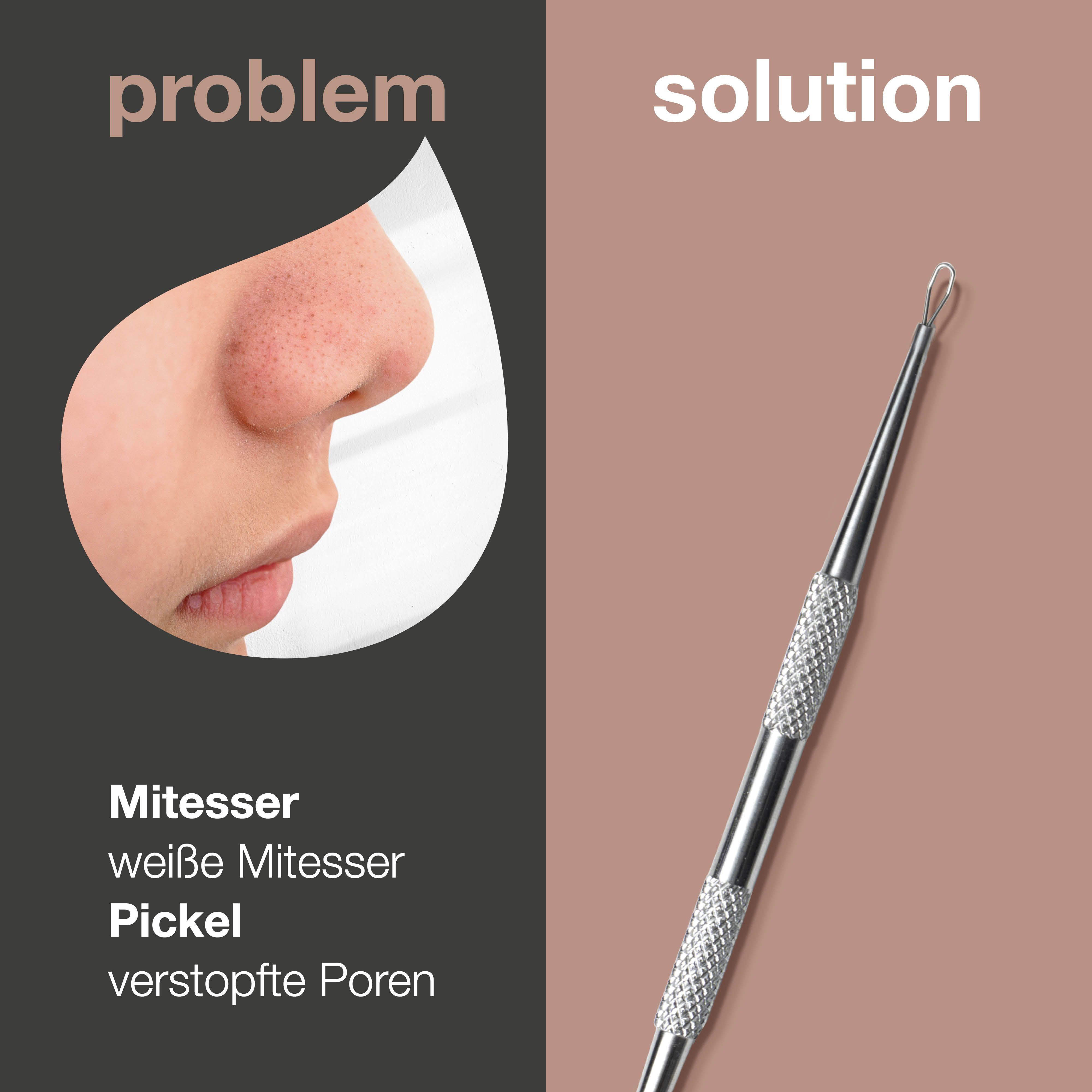 Gesicht mit Hautunreinheiten. Daneben ein Mitesserentferner. Text: Mitesser, Pickel, verstopfte Poren.