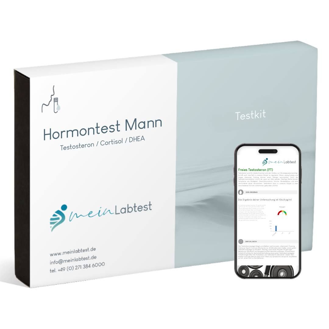 Schachtel "Hormontest Mann" und Smartphone mit Testergebnis. Logo meinlabtest.de. Weiß und hellblau.
