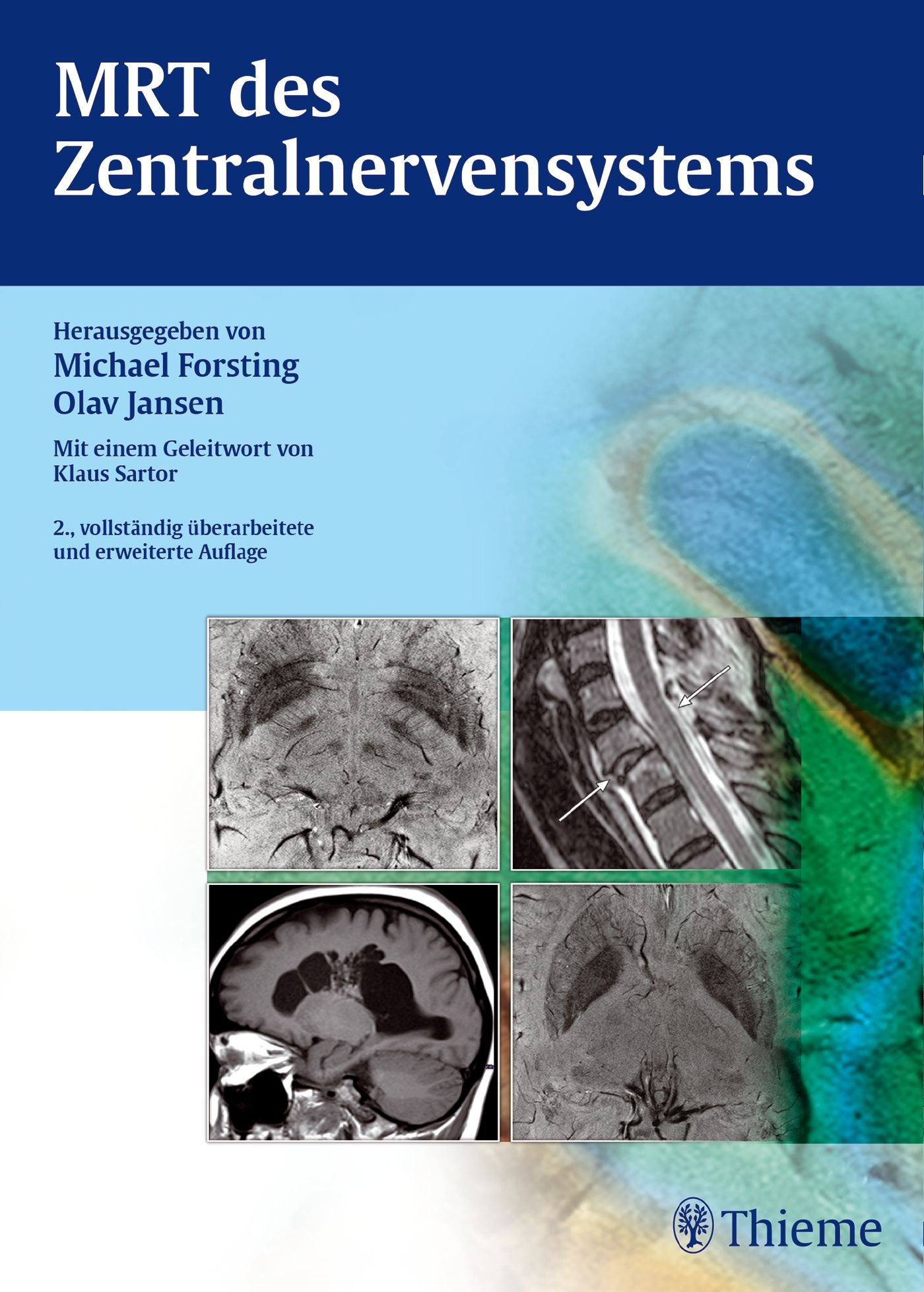 Buchcover: MRT des Zentralnervensystems. Herausgegeben von Michael Forsting und Olav Jansen. Mit Abbildungen von MRT-Scans.
