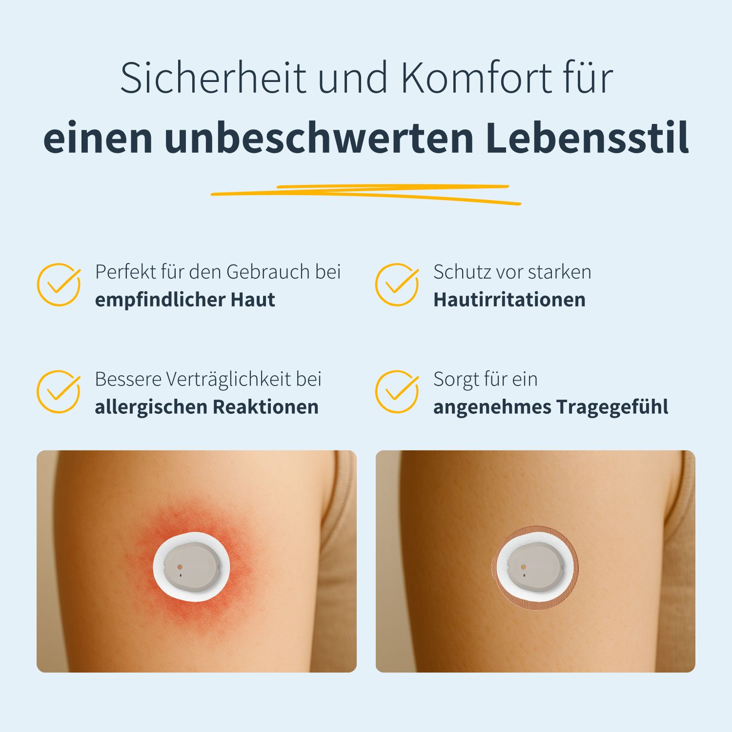 Zwei Bilder zeigen Haut mit und ohne Patch. Text: Perfekt für empfindliche Haut, Schutz vor Hautreizungen, bessere Verträglichkeit, angenehmes Tragegefühl.