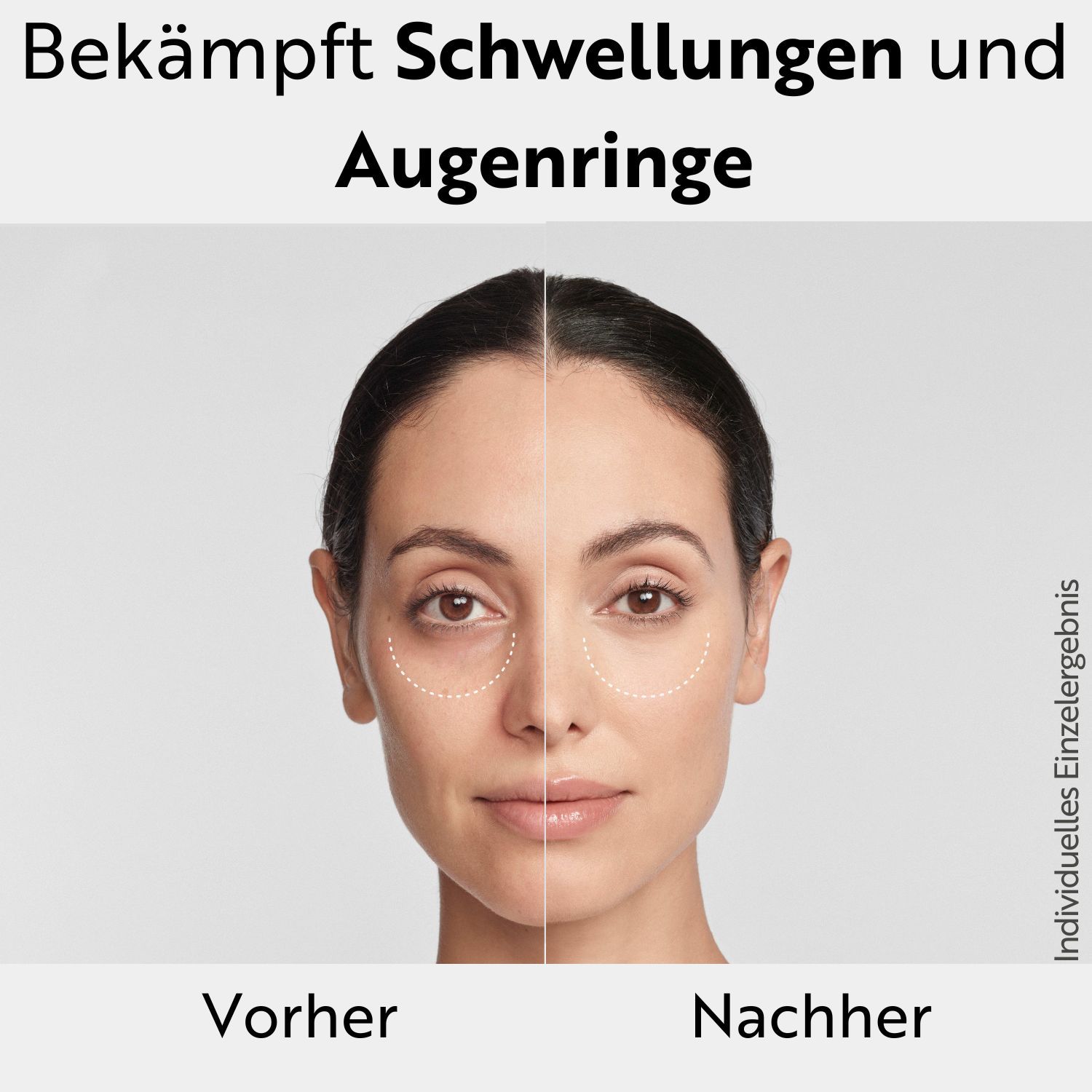 M. Asam MAGIC CARE Perfect Eye Augenserum