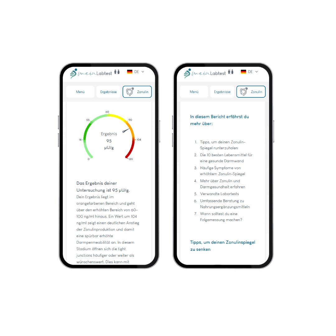 Zwei Smartphones mit Testergebnissen. Auf dem Bildschirm: Ergebnis-Diagramm und Informationen. Logo: meinLabtest.