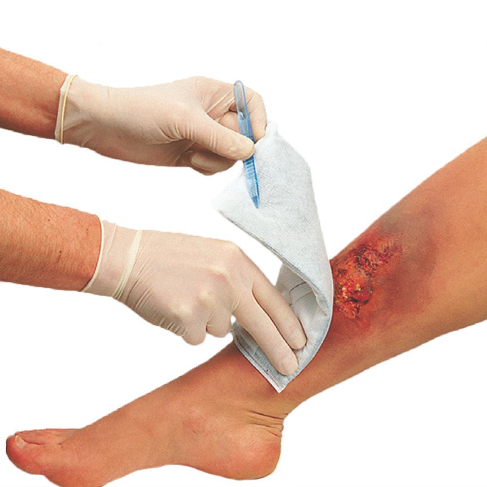 Hände mit Handschuhen halten ein steriles Tuch und einen Applikator über einer Beinwunde. Das Tuch wird auf die Wunde gelegt.