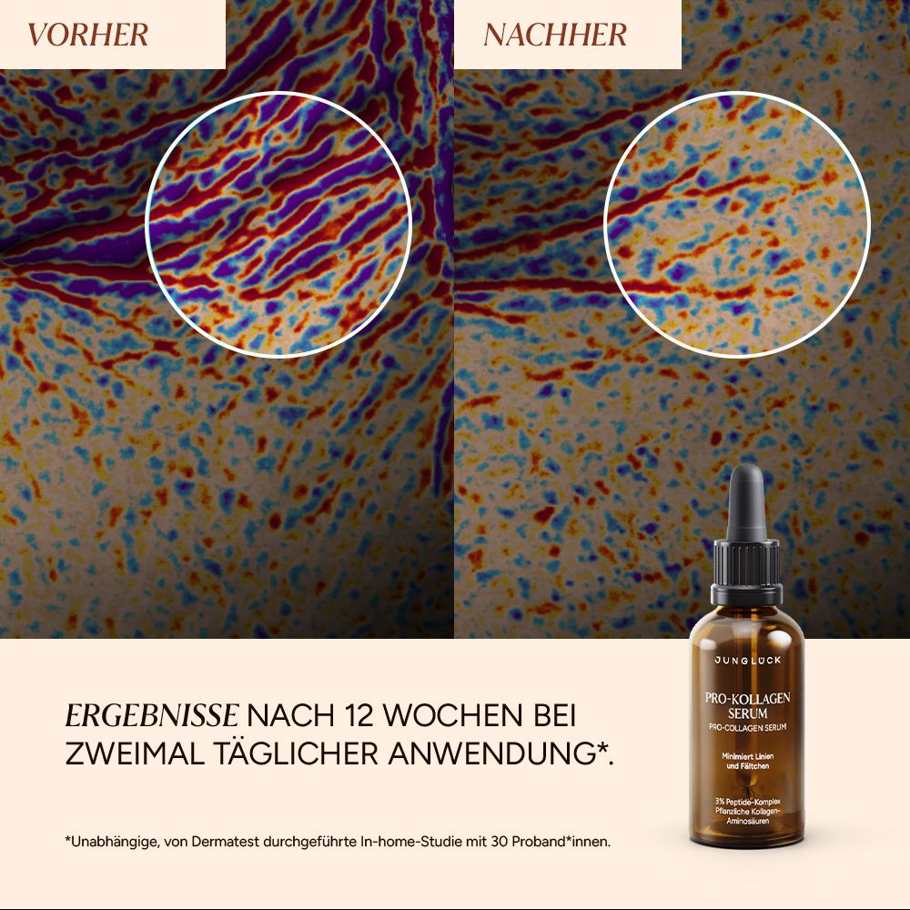 Vorher-Nachher-Vergleich von Hautbildern. Unten: Flasche Pro-Kollagen Serum. Text: Ergebnisse nach 12 Wochen.