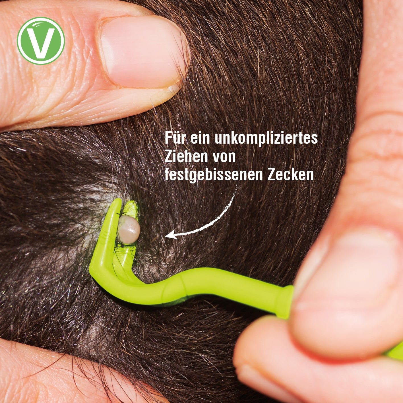 Vetlando Zeckenhaken 3er Set
