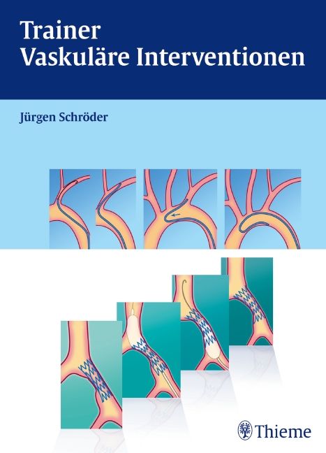 Buchcover: Trainer Vaskuläre Interventionen. Autor: Jürgen Schröder. Illustrationen von Gefäßen und medizinischen Eingriffen. Thieme-Logo.