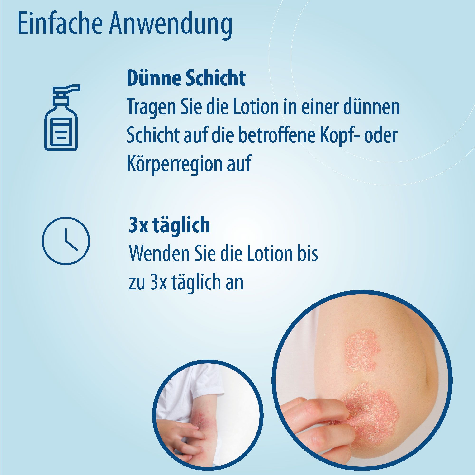 Evolsin Ekzem & Psoriasis Lotion für Kopfhaut und Körper