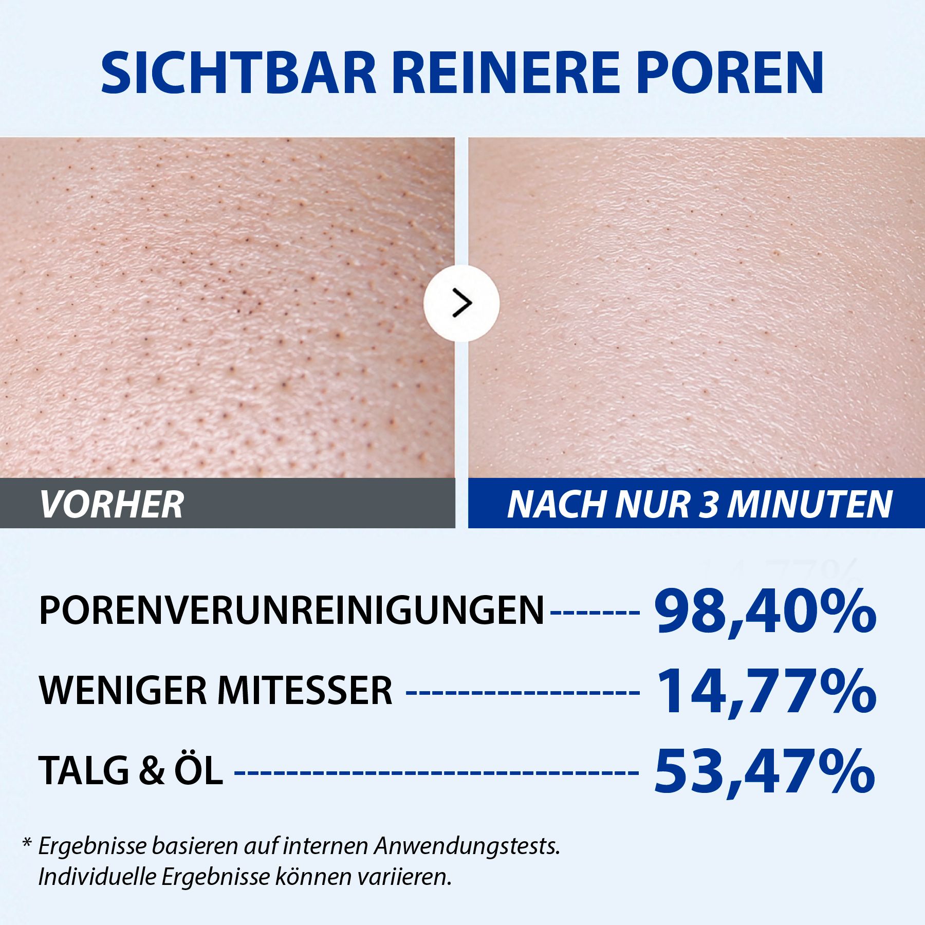 Vorher-Nachher-Vergleich der Hauttextur, der eine deutliche Verbesserung der Porenreinheit zeigt.