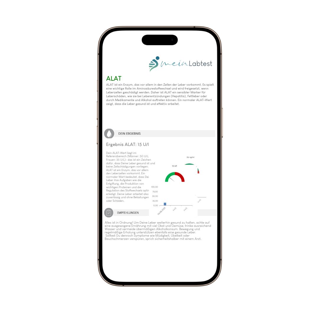 Smartphone mit Meinlabtest-App. Anzeige von ALAT-Testergebnissen mit Diagramm und Informationen.