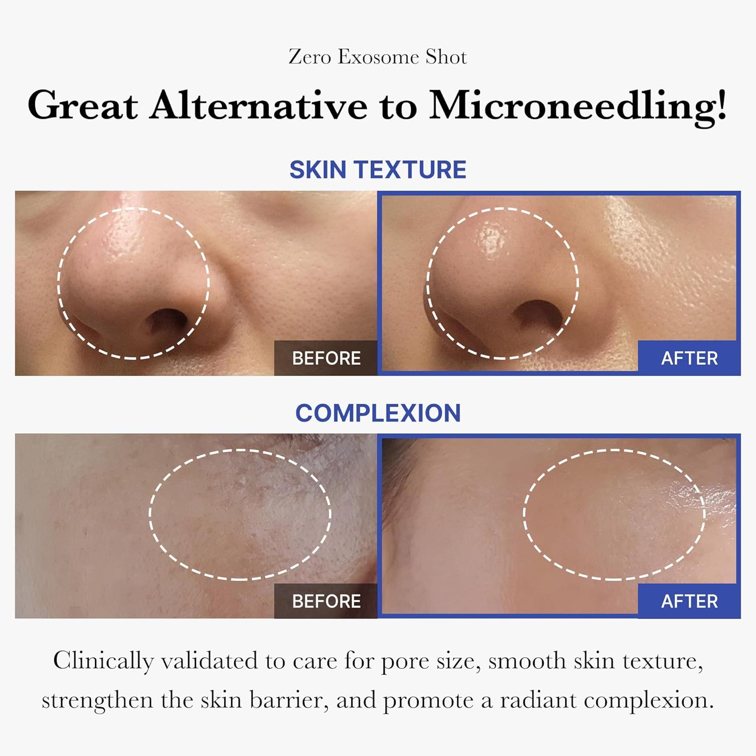 MEDICUBE One Day Exosome Shot Pore Ampoule 7500 30ml