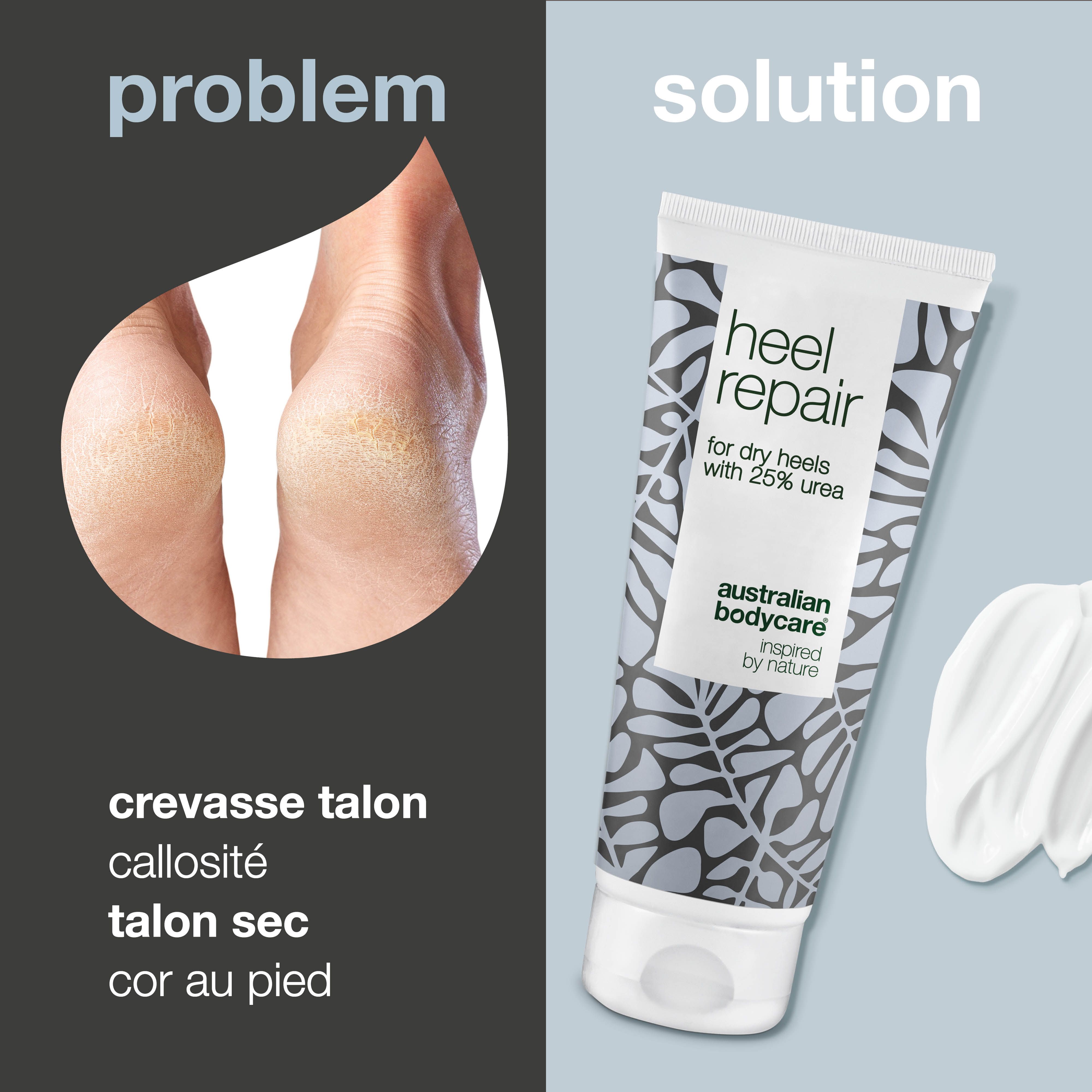 Tube de produit à côté de pieds fendillés. Texte : 'Problème' et 'Solution'.