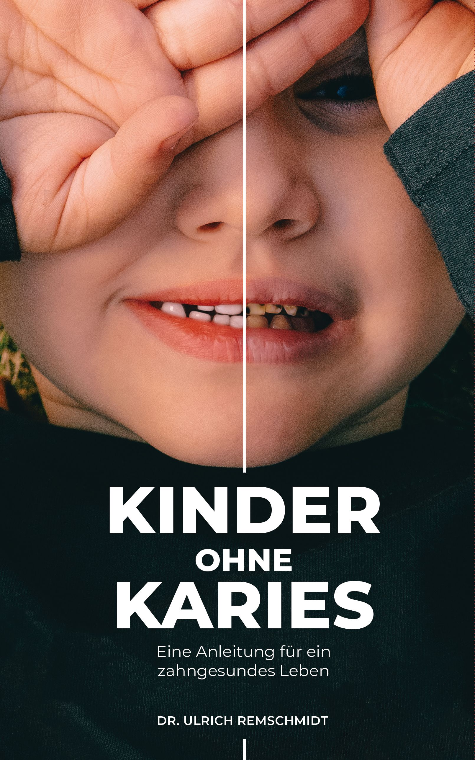 Buchcover mit geteiltem Kindergesicht. Eine Seite zeigt gesunde Zähne, die andere Karies. Titel: Kinder ohne Karies. Autor: Dr. Ulrich Remschmidt.