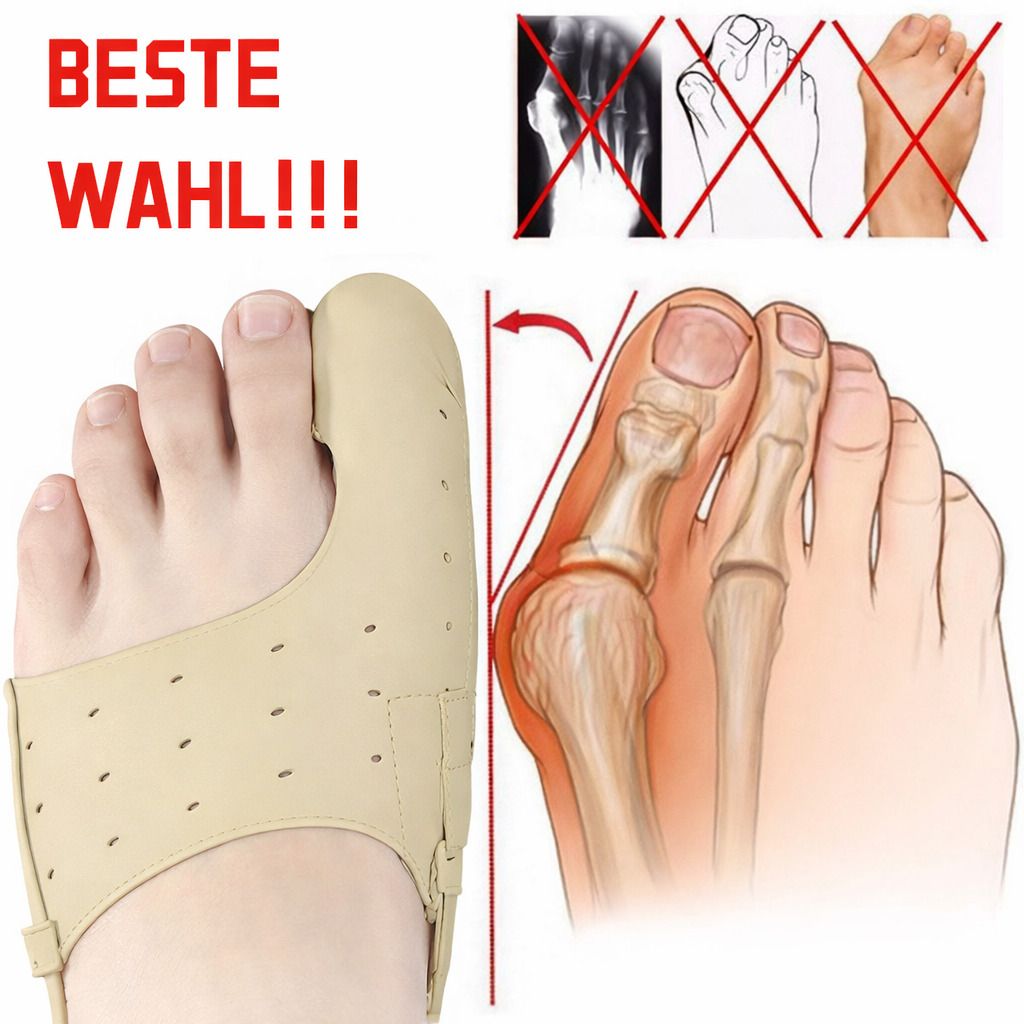 Hallux Bandage am Fuß. Beige, perforiertes Material. Anatomische Darstellung des Fußes. Text: BESTE WAHL!!!