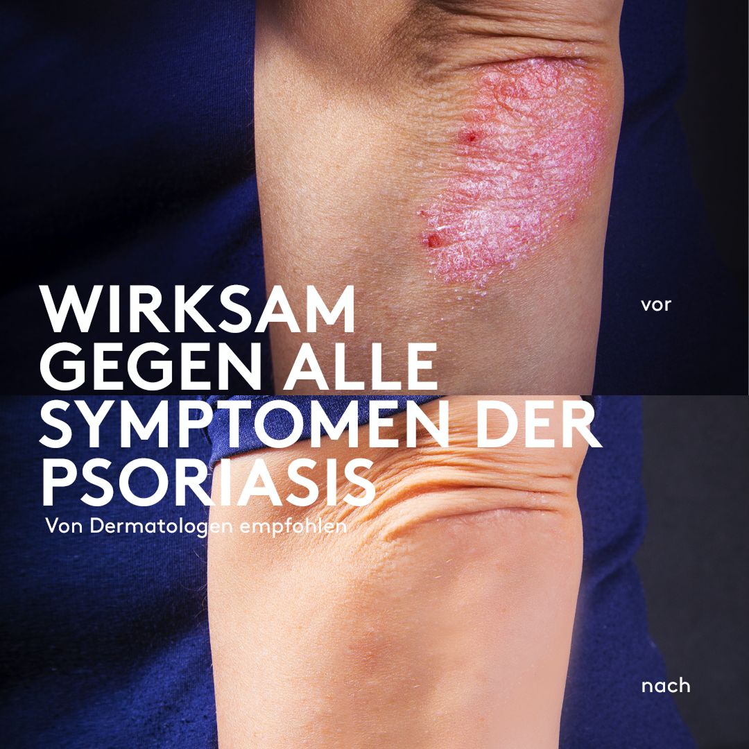 Sphagnum Botanicals Psoriasis Body Wash - mit Olivenöl & Torf-Schlamm