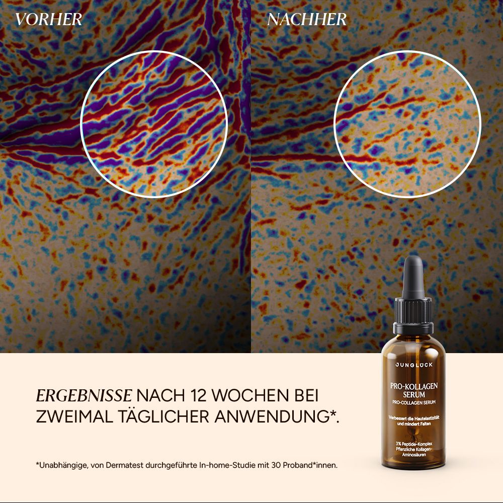 Vorher-Nachher-Vergleich. Text: Ergebnisse nach 12 Wochen bei zweimal täglicher Anwendung. Flasche Pro-Kollagen Serum.