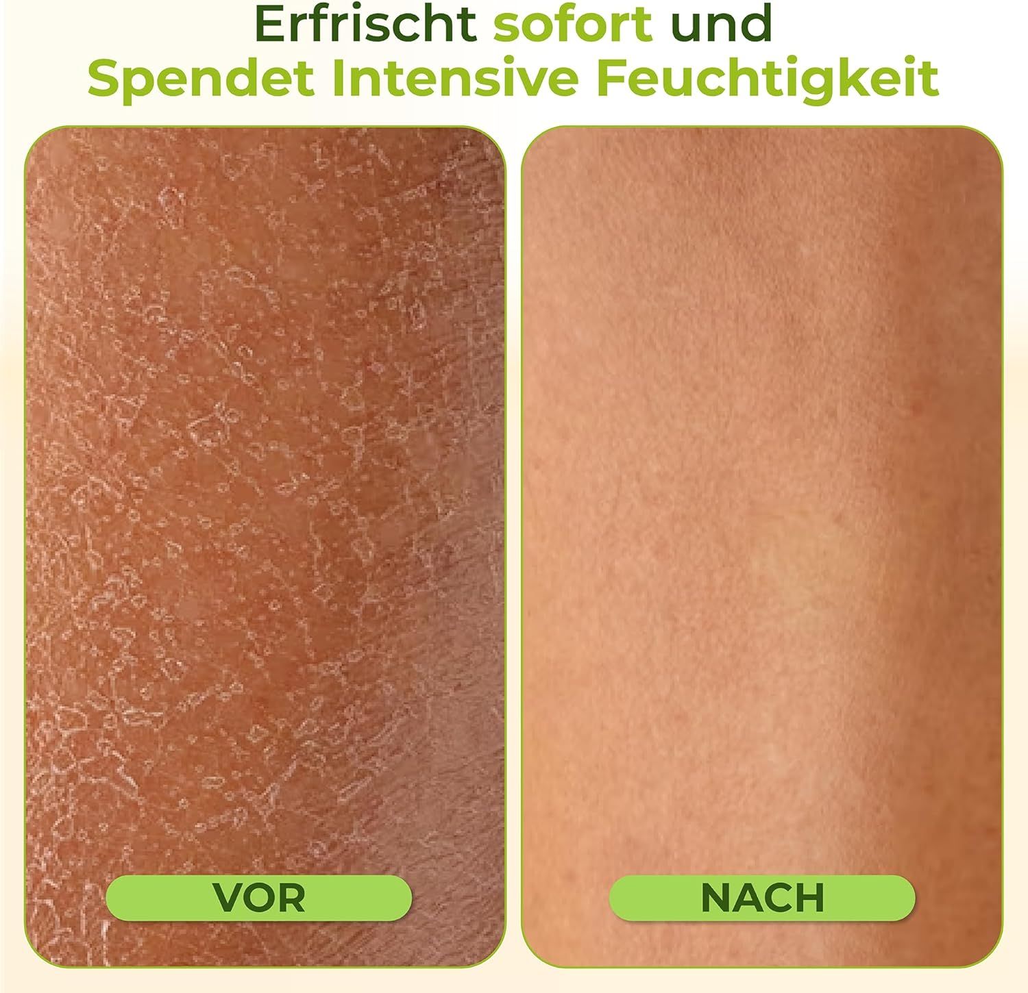 Haut vor und nach der Anwendung. Text: Erfrischt sofort und spendet intensive Feuchtigkeit. Grün-weiße Etiketten.