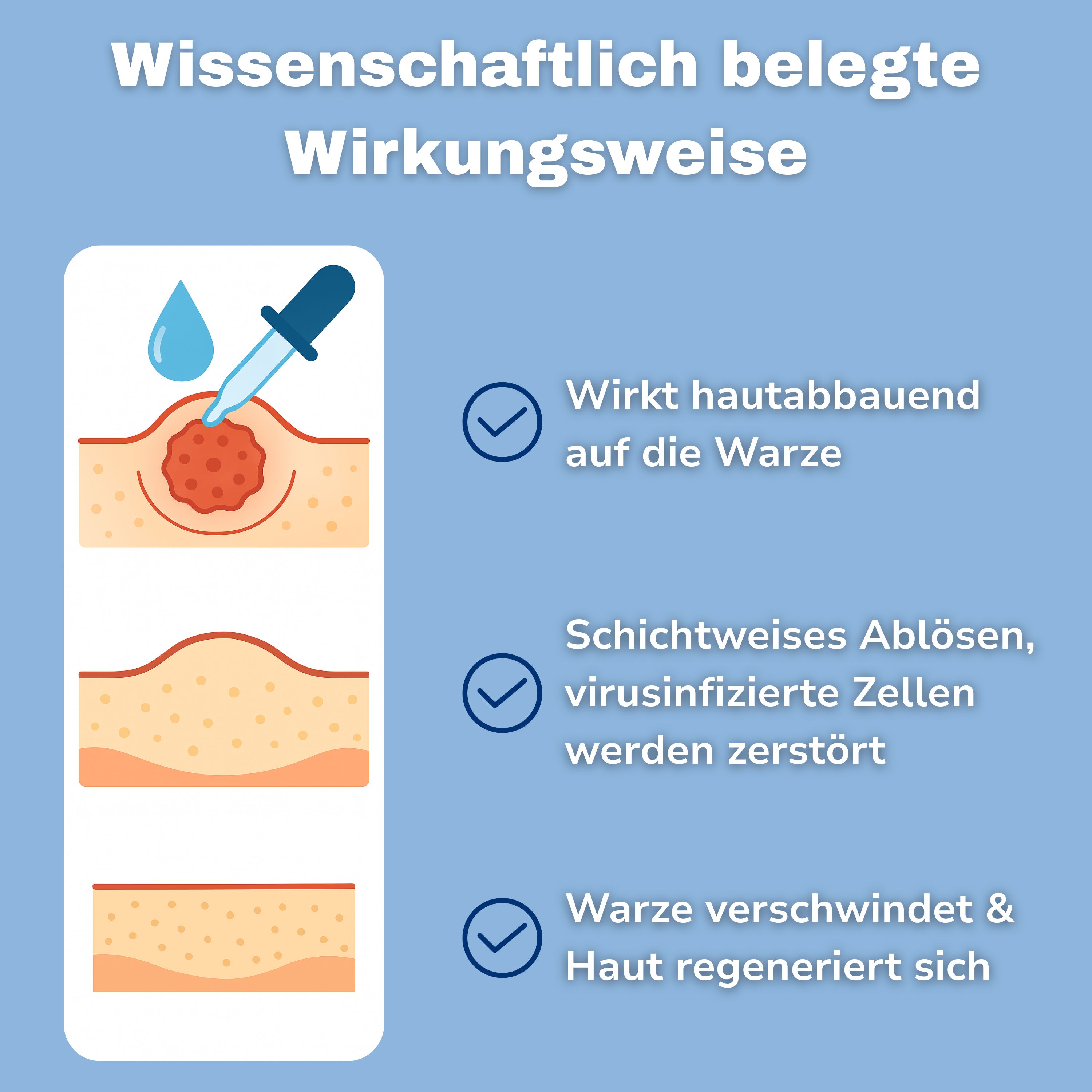 Grafische Darstellung der Wirkungsweise. Tropfen auf Warze, Ablösung der Hautschichten, Warze verschwindet.
