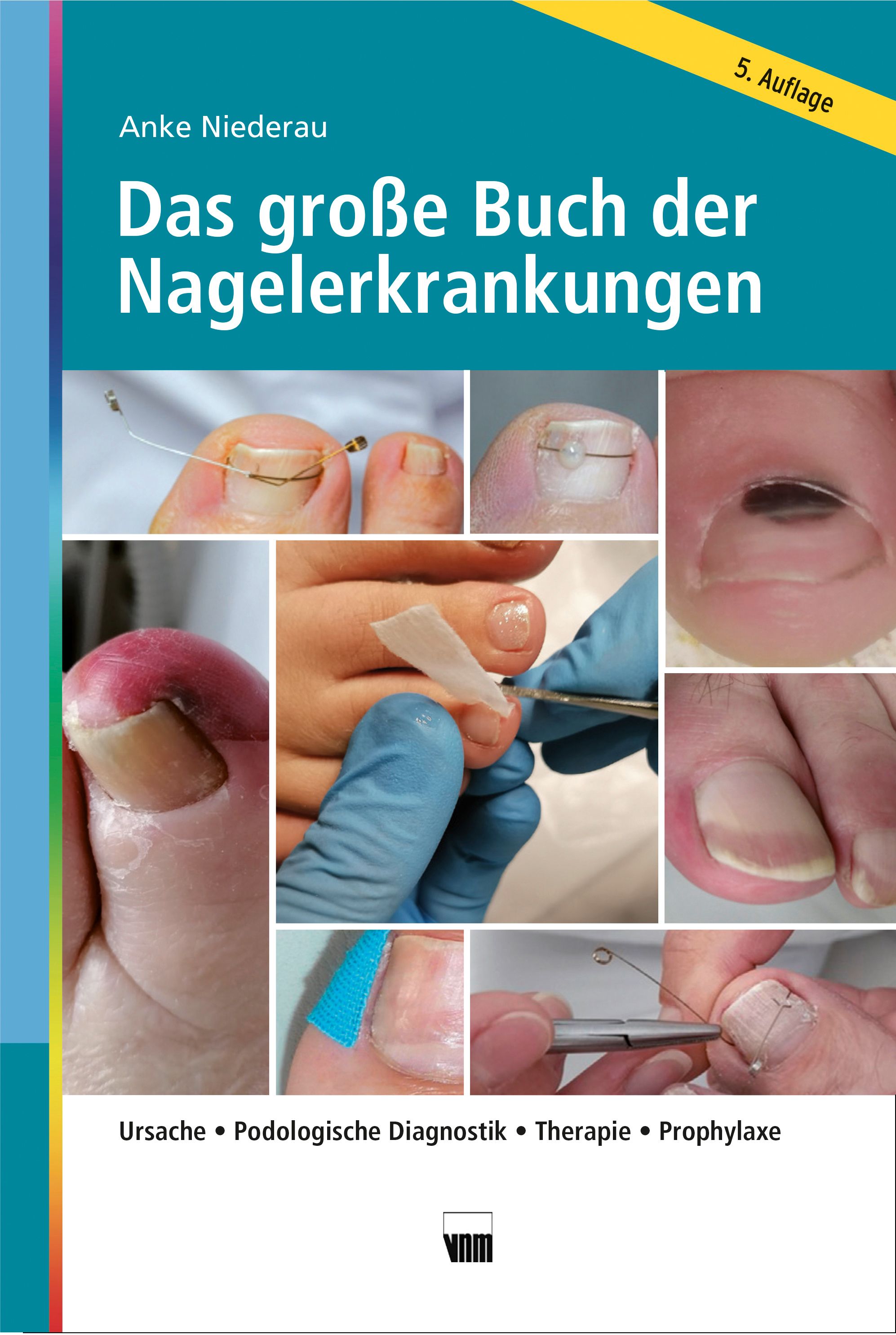 Das große Buch der Nagelerkrankungen