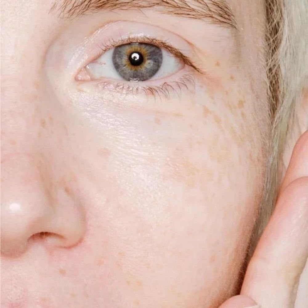 Zero Skin Gesichtsspray mit Mikrobiom-Prebiotika, feuchtigkeitsspendend für empfindliche Haut