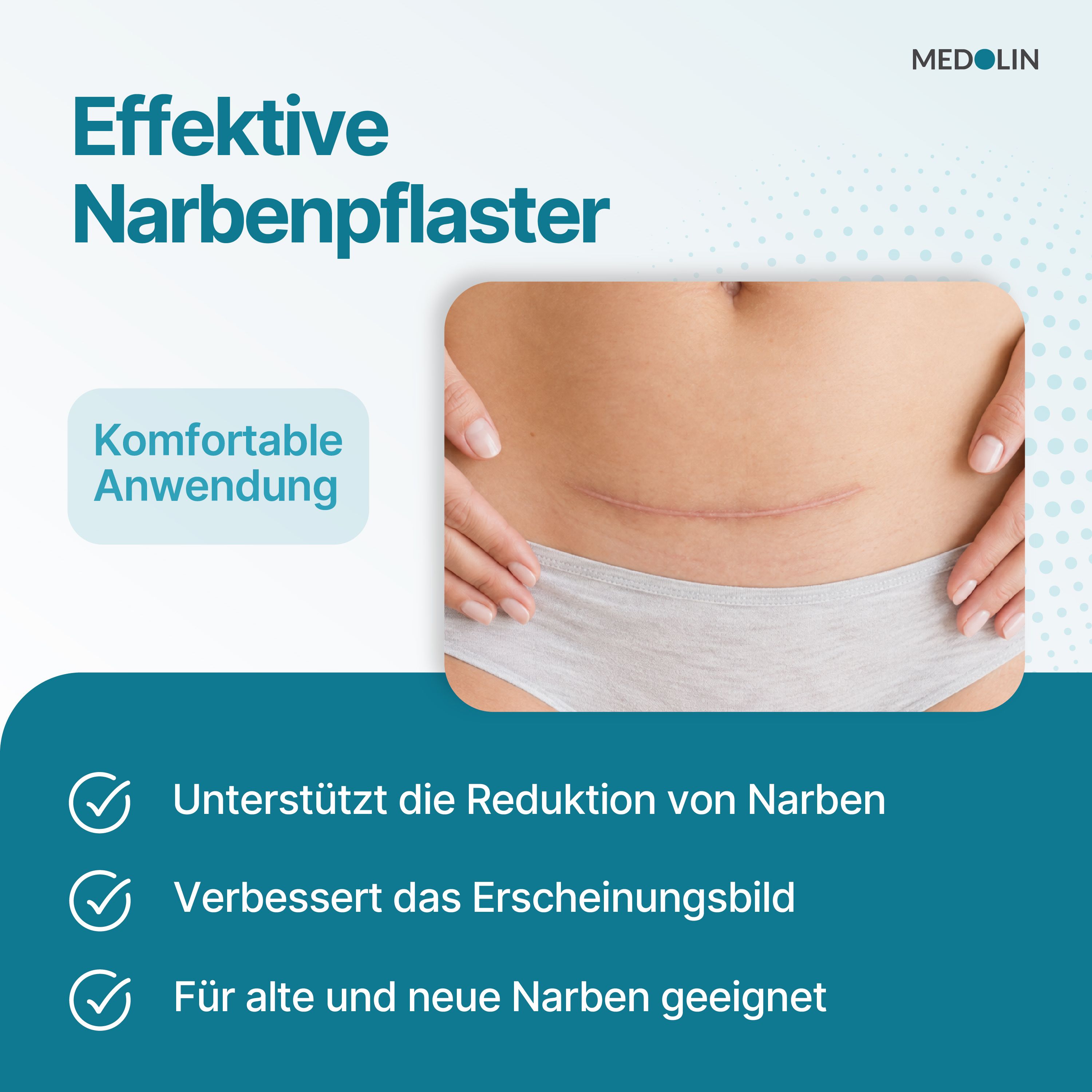 Silikonpflaster auf einer Narbe am Bauch. "Effektive Narbenpflaster" und "Komfortable Anwendung" sind auf dem Bild zu sehen.