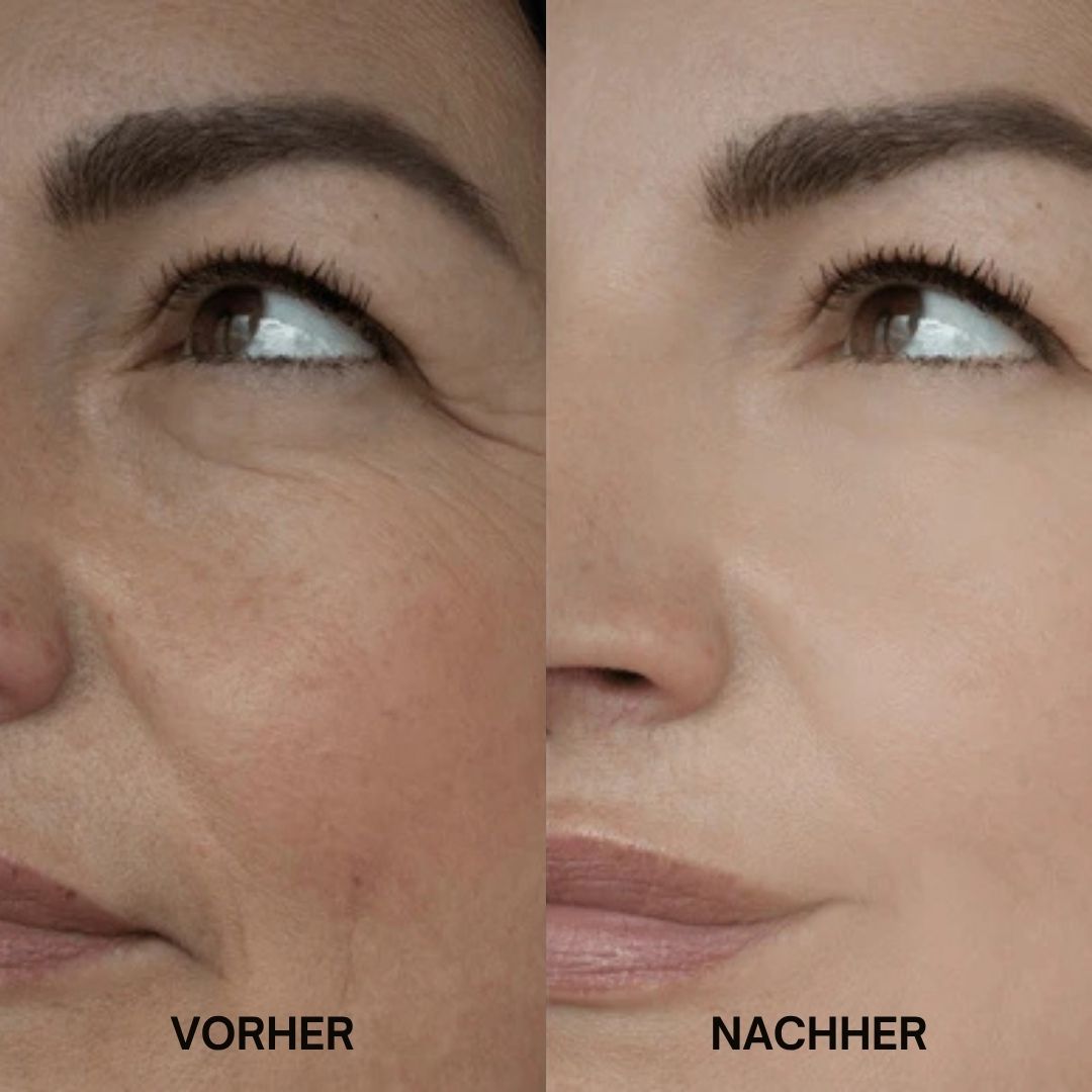 Vorher-Nachher-Vergleich von Haut. Links: Haut mit Falten. Rechts: Glattere Haut.