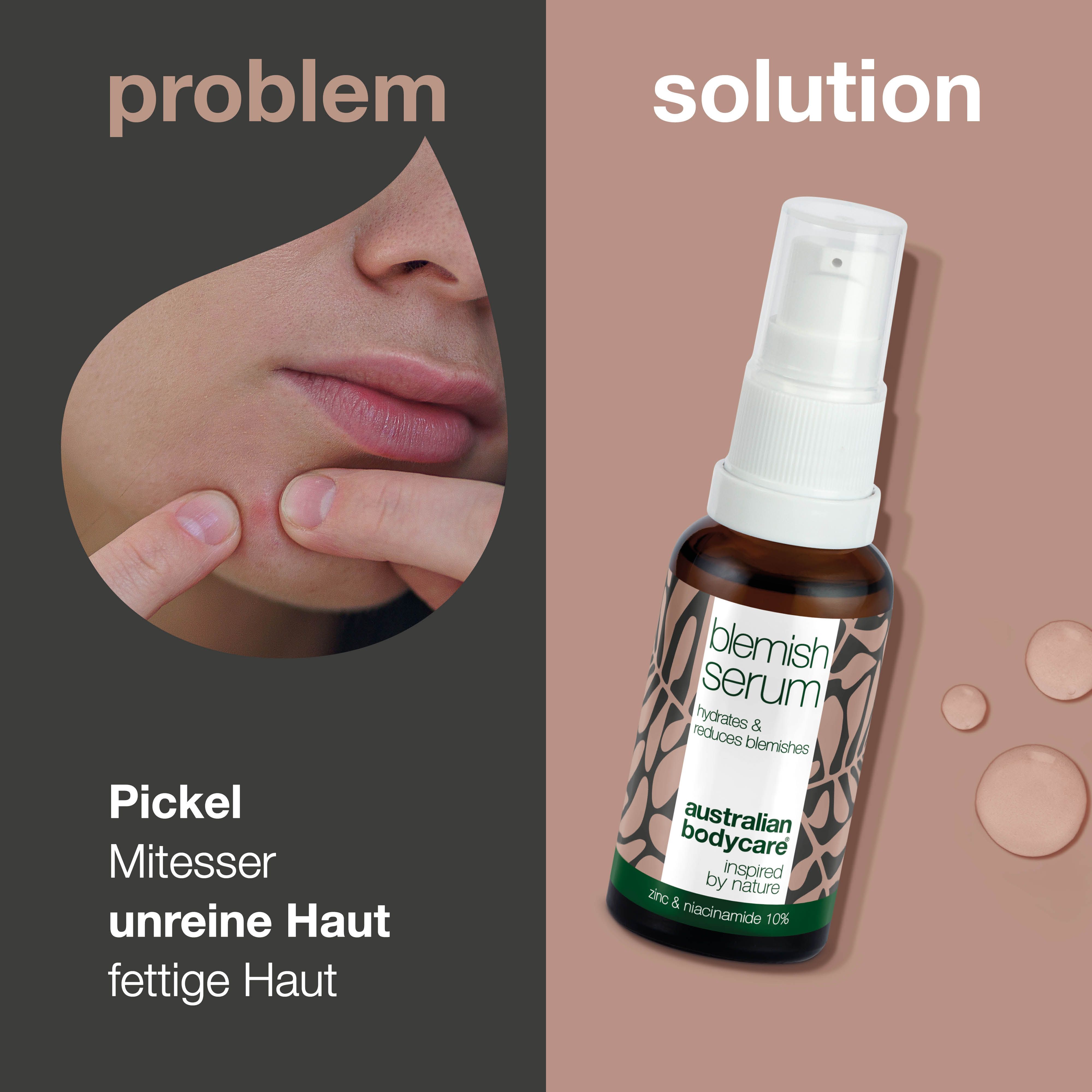 Bild zeigt Pickel und eine Flasche Blemish Serum. Aufschrift: Blemish Serum, hydratisiert & reduziert Hautunreinheiten. Marke: Australian Bodycare.