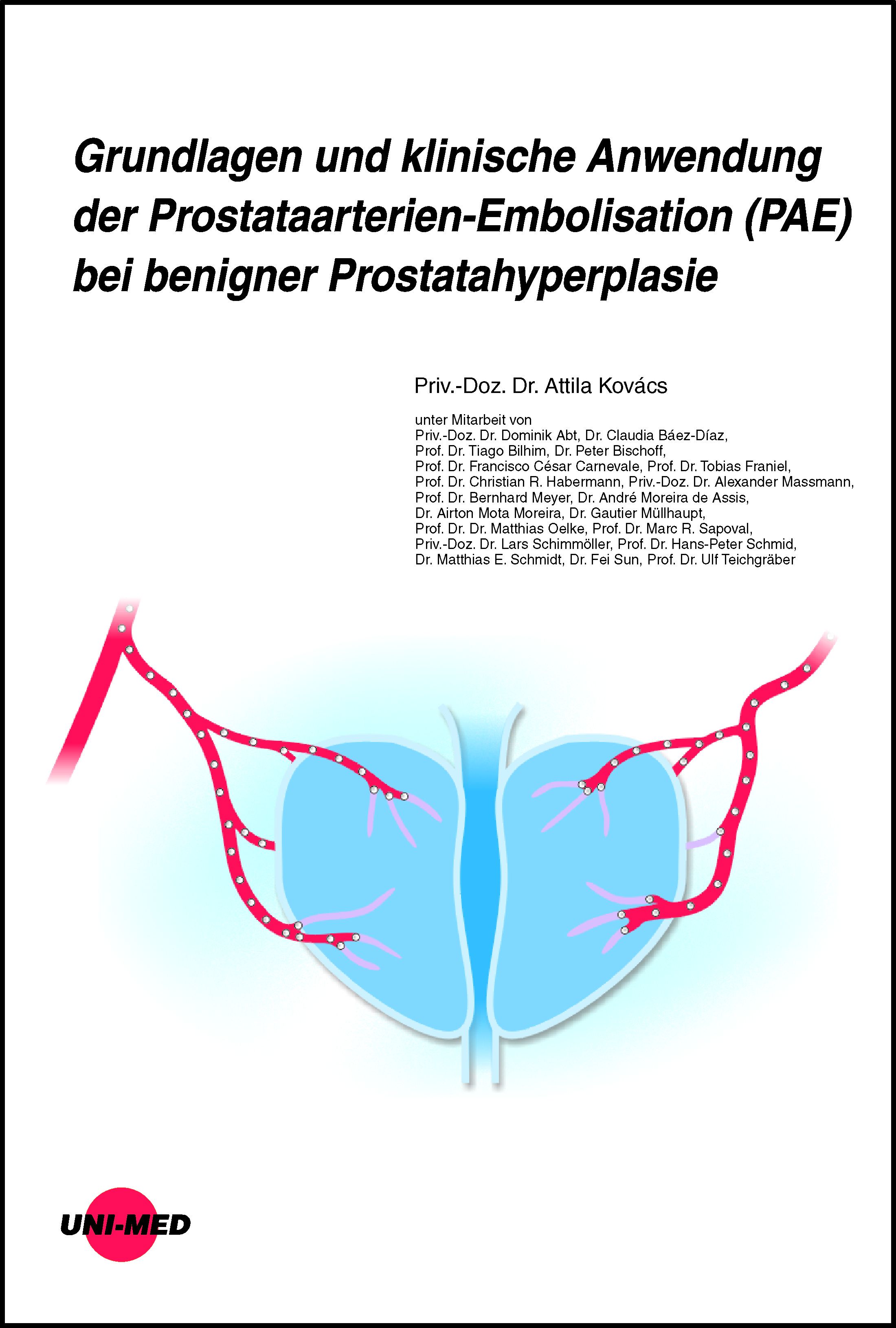 Grundlagen und klinische Anwendung der Prostataarterien-Embolisation (Pae) bei benigner