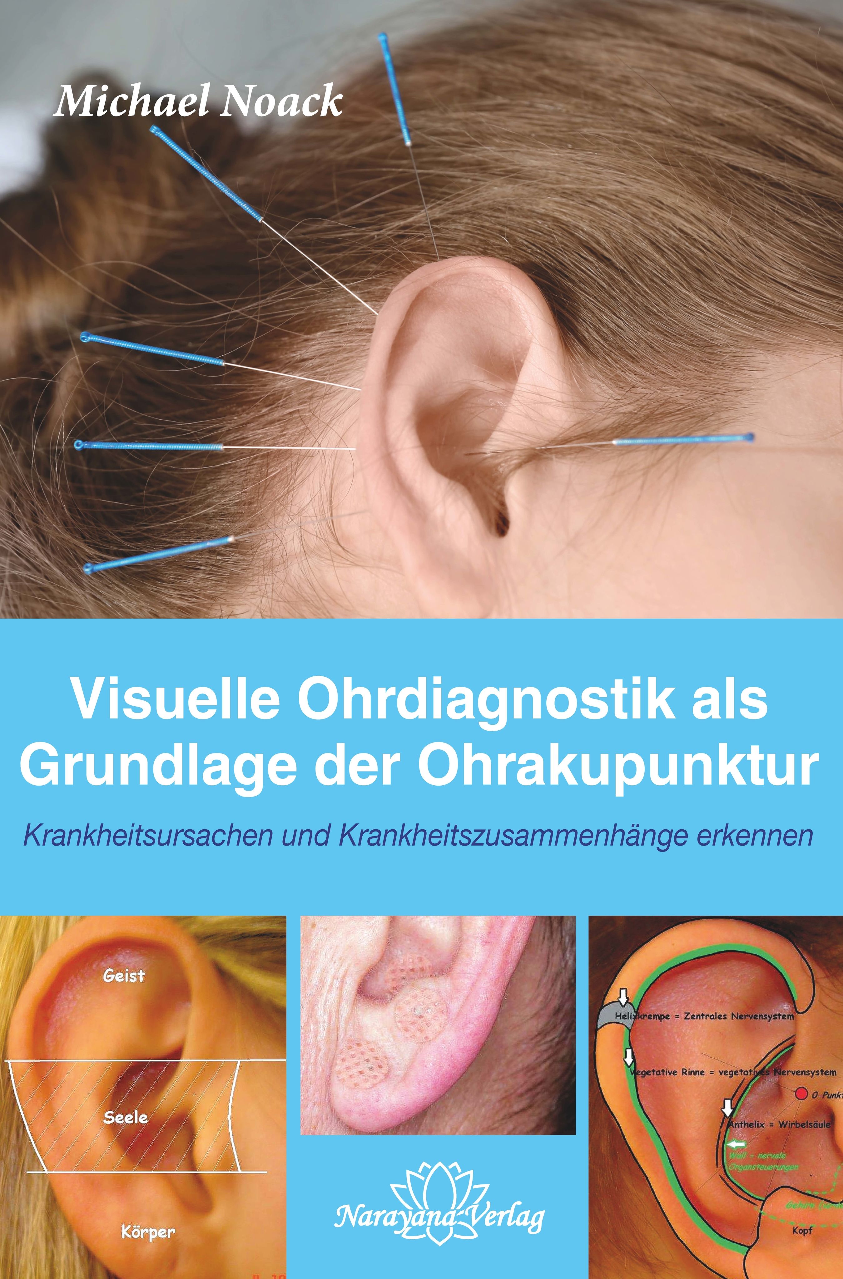 Buchcover mit Ohrabbildungen und Akupunkturnadeln. Titel: Visuelle Ohrdiagnostik als Grundlage der Ohrakupunktur. Autor: Michael Noack.