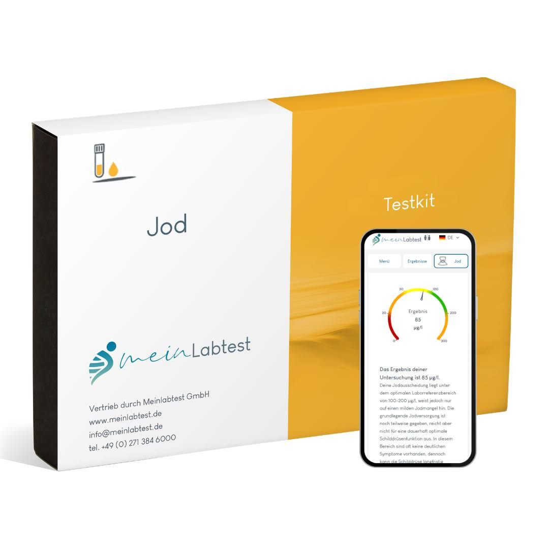 Weiß-gelbe Box mit Smartphone. Box mit "Jod Testkit". Smartphone zeigt Testergebnis.