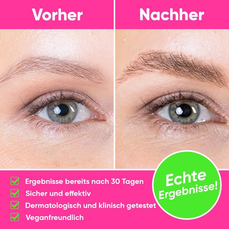 Vorher-Nachher-Vergleich von Augenbrauen. Ergebnisse nach 30 Tagen.