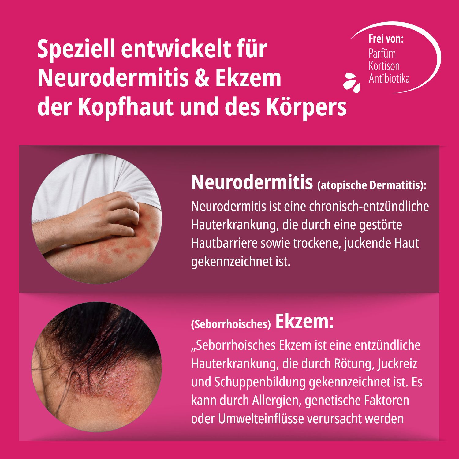 Evolsin® Ekzem & Neurodermitis Creme 3er Pack - Mindert Juckreiz & beruhigt gereizte Haut