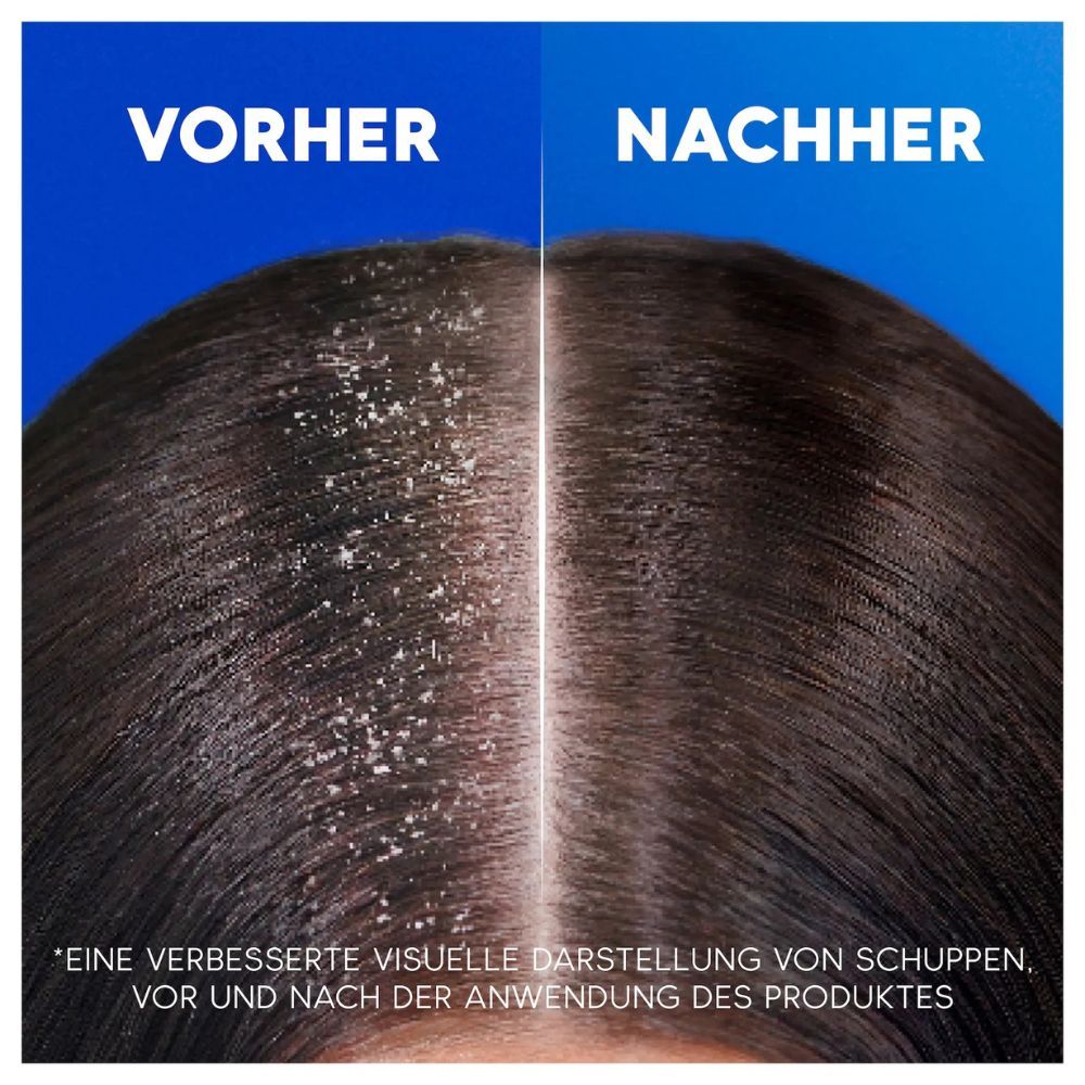 Head & Shoulders Classic Clean 2in1 Anti-Schuppen Shampoo Sonderpack, 250ml