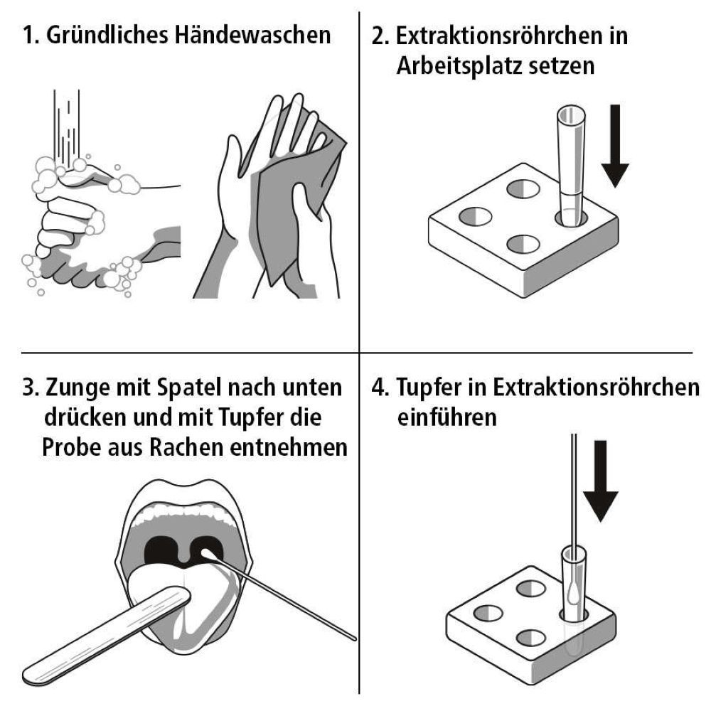 Schritt-für-Schritt-Anleitung zur Durchführung eines Tests. Illustrationen zeigen Händewaschen, Probenentnahme und Testdurchführung.