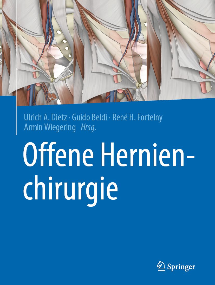 Buchcover mit Titel "Offene Hernienchirurgie". Autorennamen und Springer-Logo sind ebenfalls sichtbar.