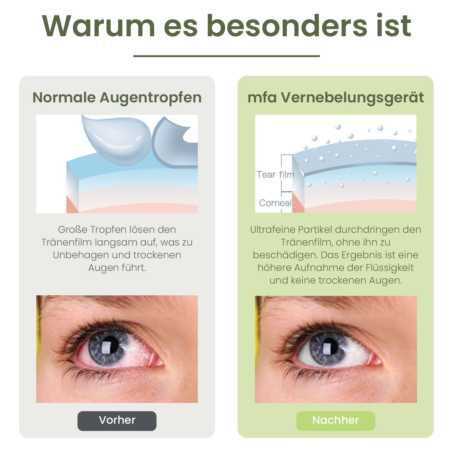 mfa® Nano Mister gegen trockene Augen