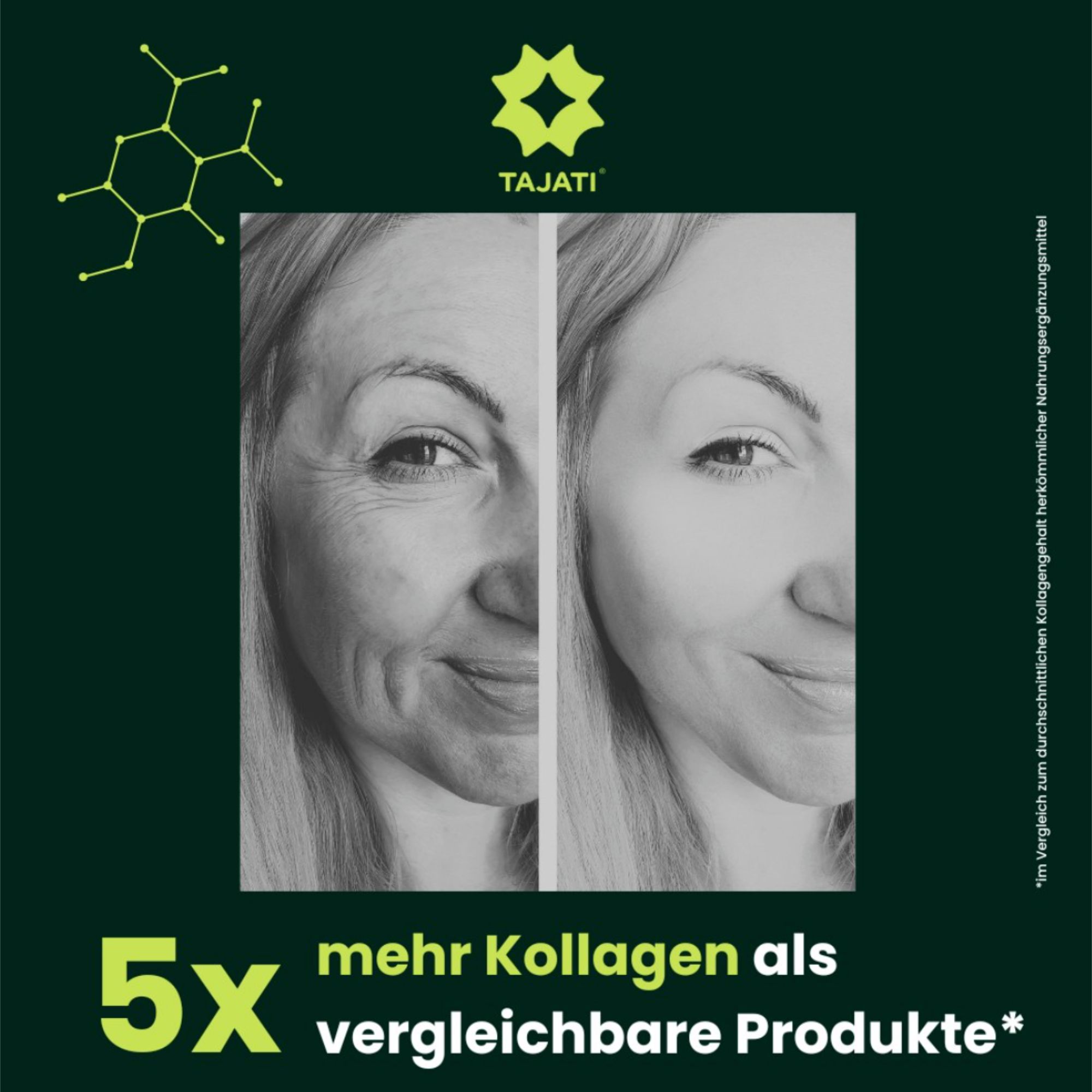 TAJATI® 5-in-1 Full Spectrum Lifestyle Formel – Kollagen, Glucosamin, MSM, Niacin & Chondroitin