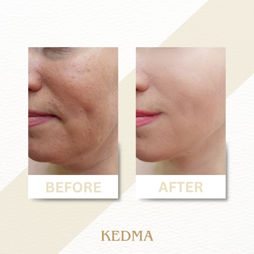 Kedma - Body Butter Pure Lilac