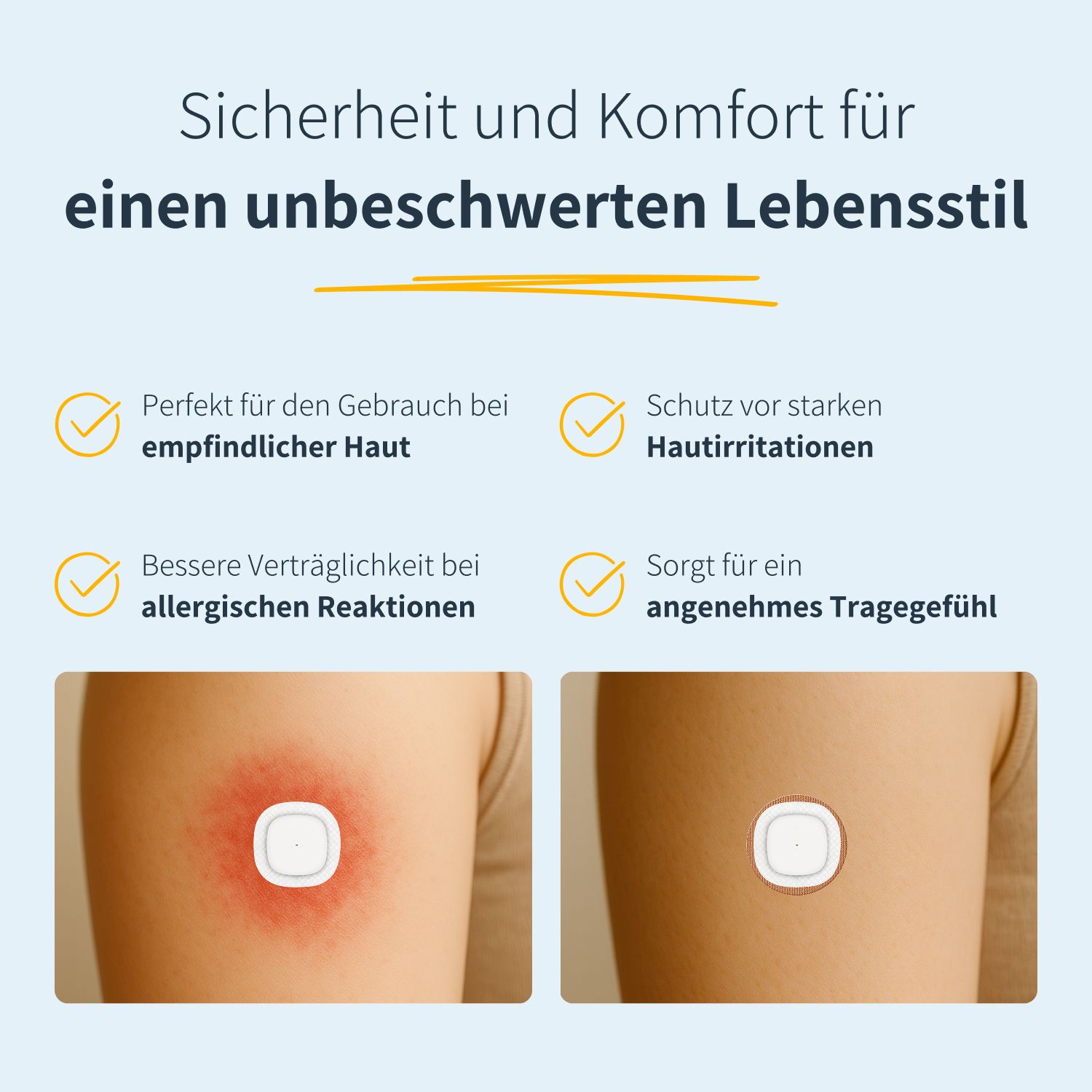 Zwei Arme zeigen Hautirritationen und einen Underpatch. Der Patch schützt vor Irritationen und ist für empfindliche Haut.