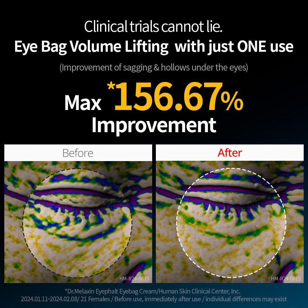 Vorher-Nachher-Vergleich von Augenpartien. Zeigt eine Verbesserung von 156,67%.