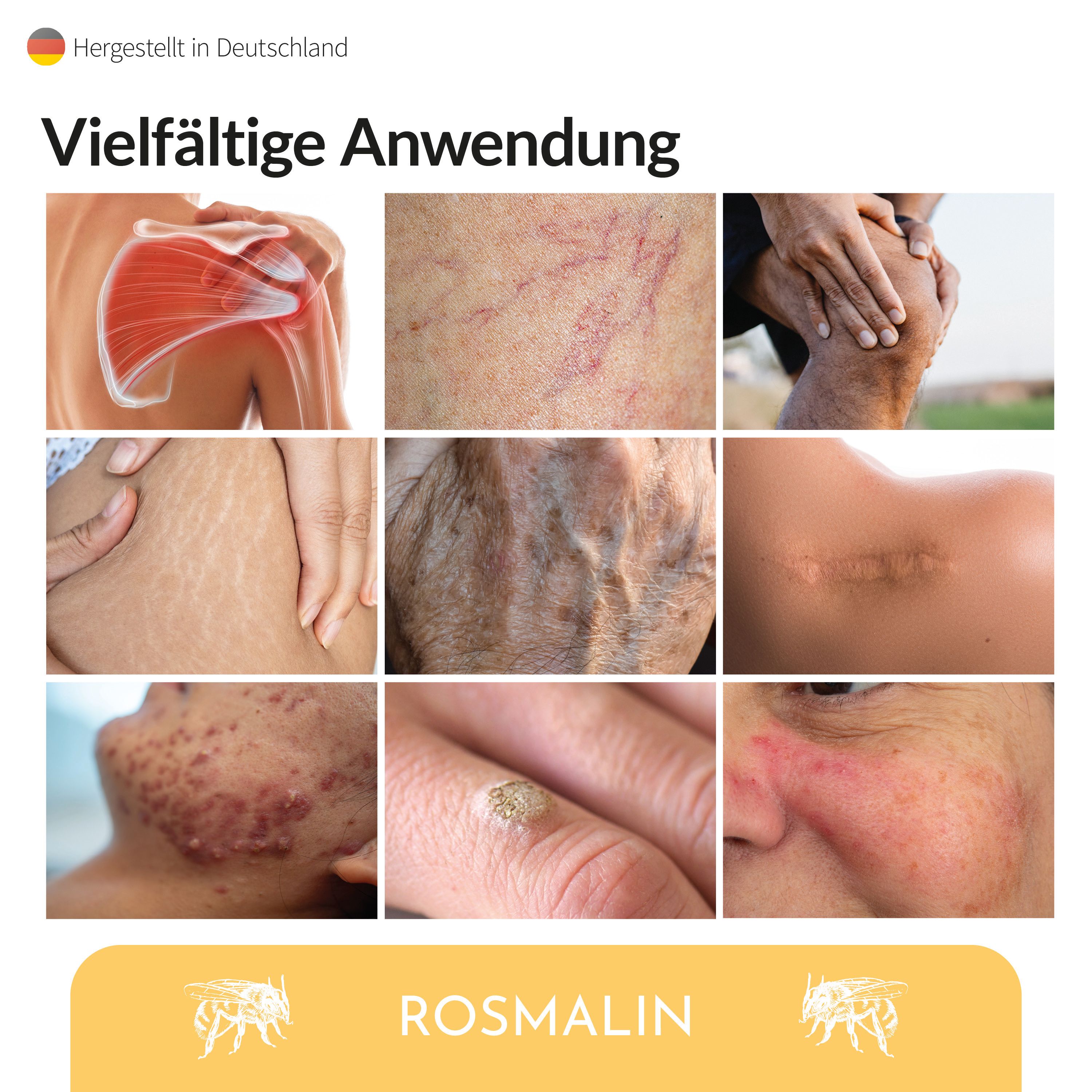 Collage von Bildern, die Hautzustände zeigen. Bilder zeigen: Gelenk, Haut mit Krampfadern, Narbe, Hautausschlag, Warze, Gesichtsrötung.