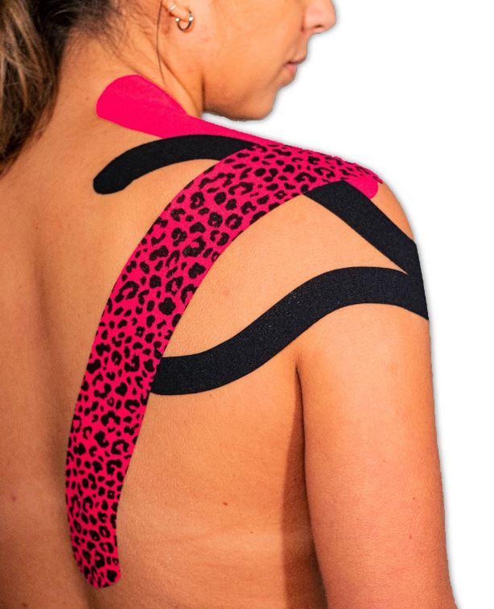 Rosa und schwarzes Kinesiotape mit Leopardenmuster auf der Schulter und dem Rücken einer Person.
