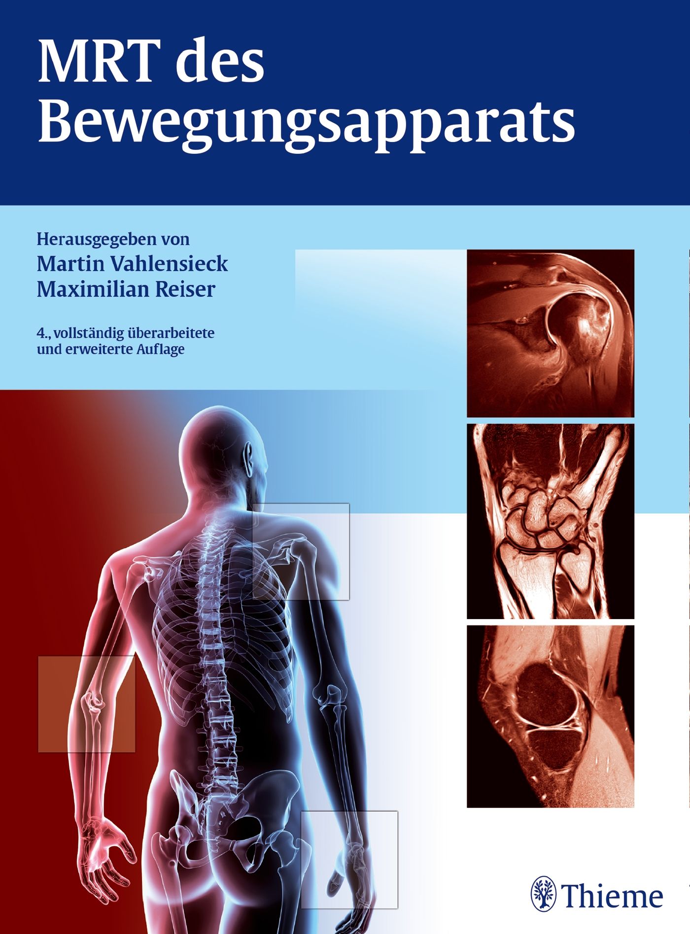 Buchcover: MRT des Bewegungsapparats. Herausgegeben von Martin Vahlensieck und Maximilian Reiser. 4. Auflage. Abbildungen von Knochenstrukturen.