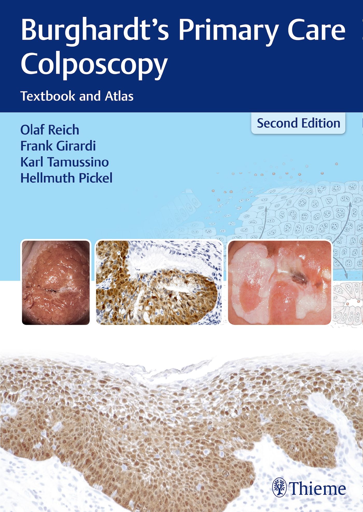 Buchcover: Burghardt's Primary Care Colposcopy, Lehrbuch und Atlas. Autoren: Reich, Girardi, Tamussino, Pickel. Thieme Verlag.