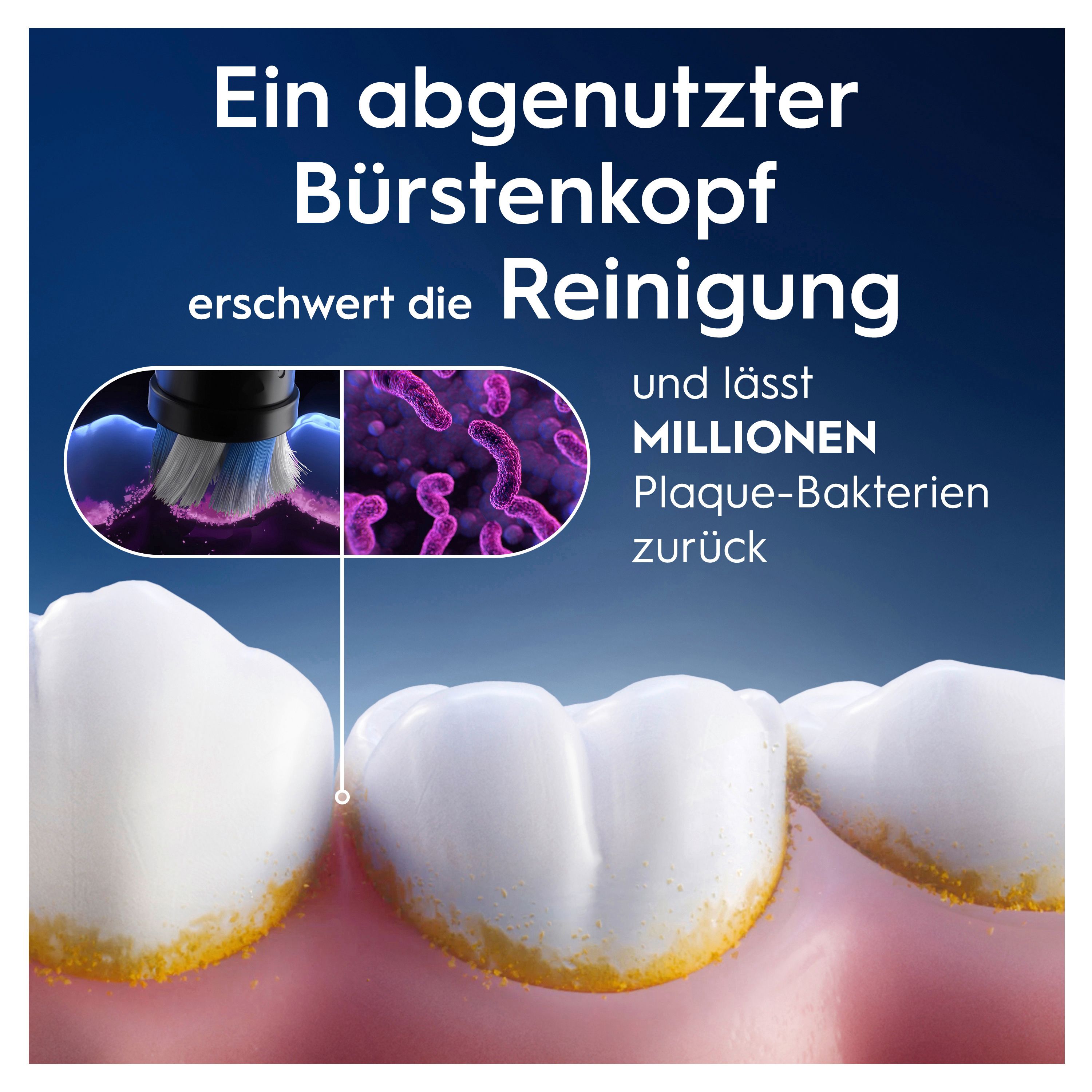Nahaufnahme von Zähnen und einer Zahnbürste. Text: "Ein abgenutzter Bürstenkopf erschwert die Reinigung".