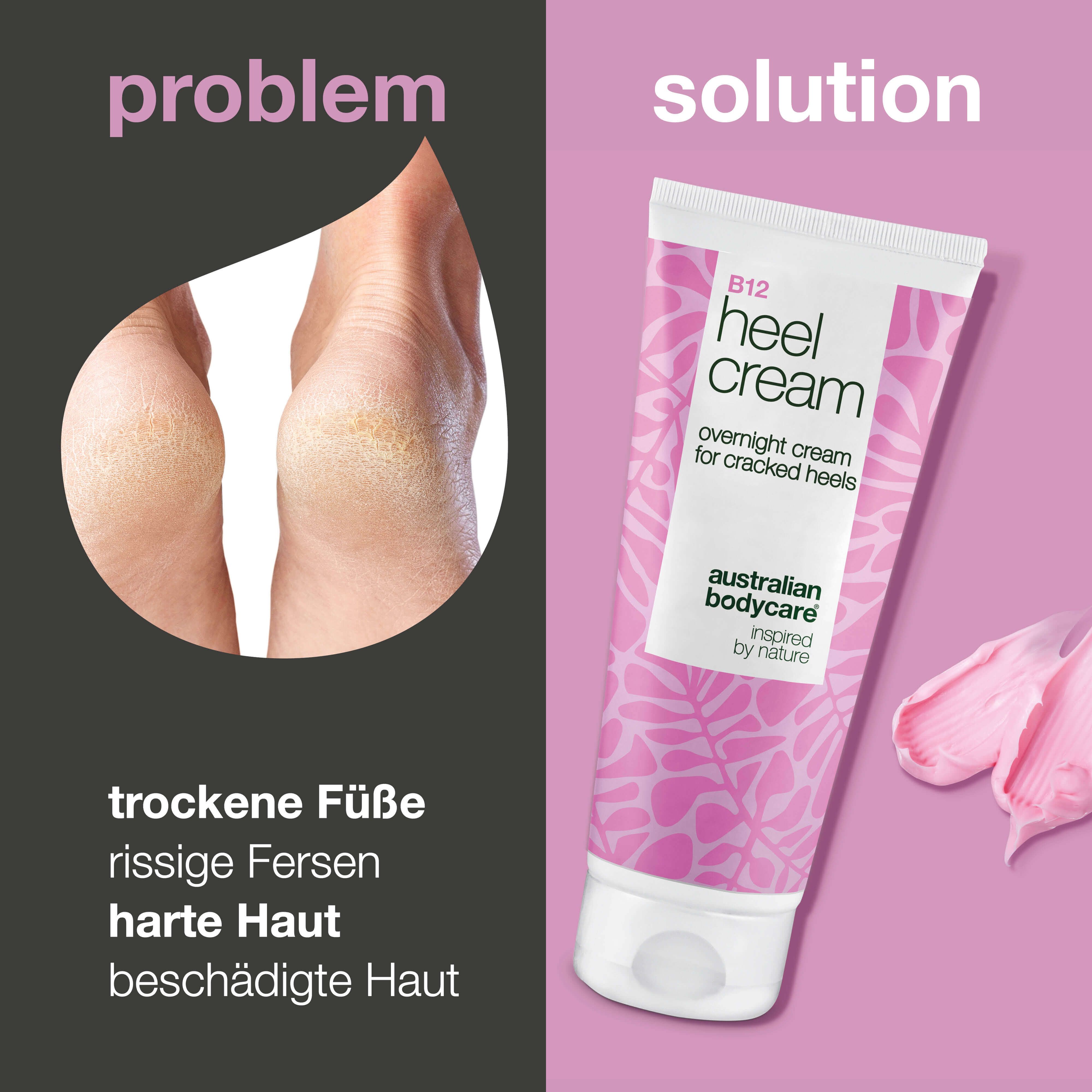 Füße mit trockenen Fersen. Rechts: Tube B12 Heel Cream. Rosa Creme-Klecks. Text: overnight cream for cracked heels.