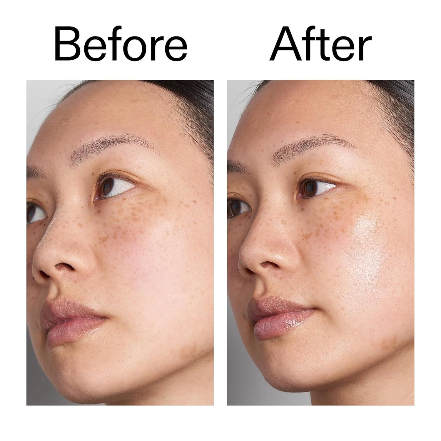 Vorher-Nachher-Vergleich zweier Gesichter. Hautbild vor und nach der Anwendung. Deutliche Verbesserung.