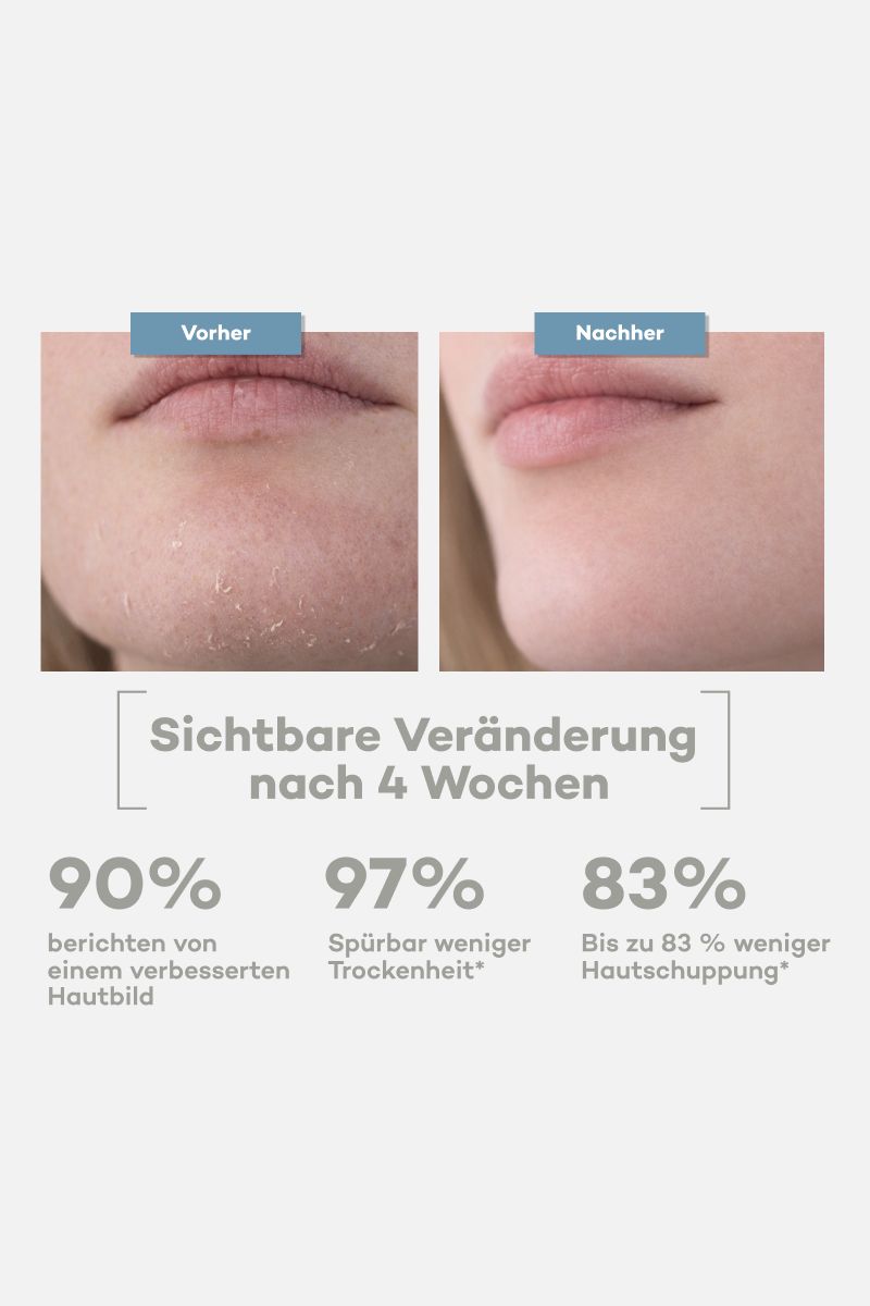 Tallow Everyday Moisturizer Flower – Creme für empfindliche & trockene Haut – Bio Rindertalg (120ml)