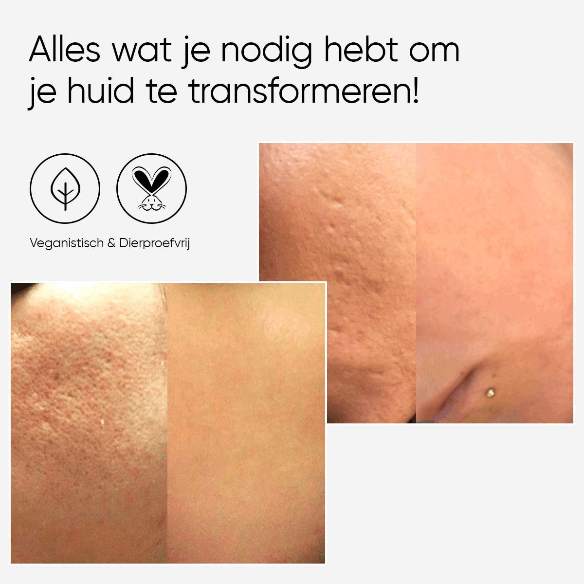Voor- en na foto's van de huid. Tekst over veganistische en dierproefvrije producten.