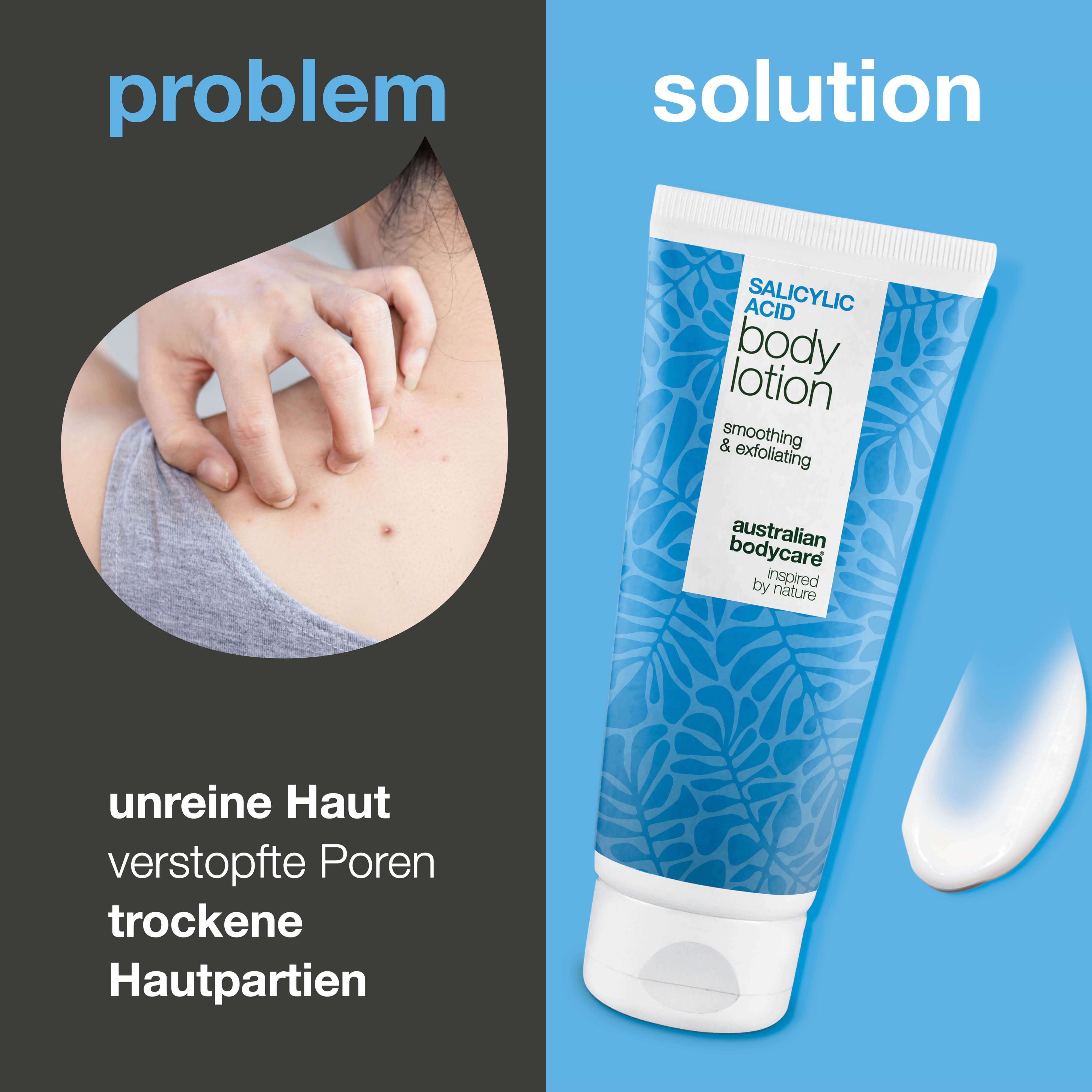 Vergleich: Problem (Haut) und Lösung (Tube). Tube: Salicylic Acid Body Lotion, Australian Bodycare.